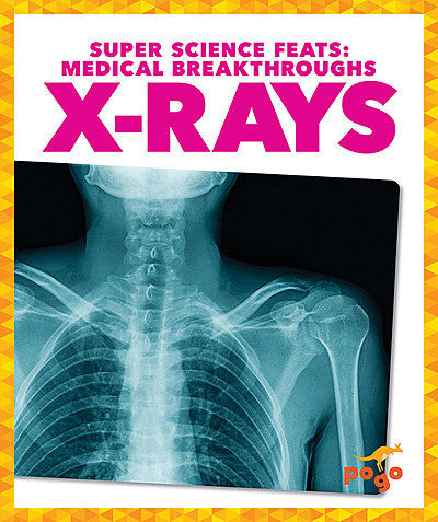 Super Science Feats: X-Rays