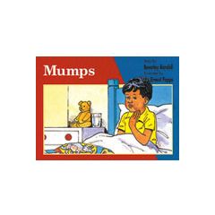 Mumps